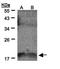 Interleukin 36 Gamma antibody, orb69930, Biorbyt, Western Blot image 