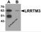 Leucine-rich repeat transmembrane neuronal protein 3 antibody, 6171, ProSci, Western Blot image 