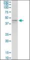Potassium Voltage-Gated Channel Subfamily J Member 5 antibody, orb375969, Biorbyt, Western Blot image 