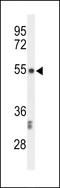 Centromere Protein I antibody, LS-C168667, Lifespan Biosciences, Western Blot image 