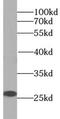 Somatomedin-C antibody, FNab04169, FineTest, Western Blot image 