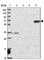 Rho GTPase-activating protein 19 antibody, HPA043231, Atlas Antibodies, Western Blot image 