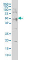 Bile Acid-CoA:Amino Acid N-Acyltransferase antibody, LS-C196730, Lifespan Biosciences, Western Blot image 