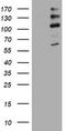 ALK Receptor Tyrosine Kinase antibody, TA801405S, Origene, Western Blot image 