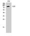 Valosin Containing Protein antibody, STJ96231, St John