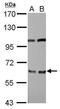 Eukaryotic translation initiation factor 3 subunit D antibody, GTX101424, GeneTex, Western Blot image 