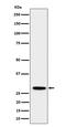 Proteasome Subunit Beta 10 antibody, M04960-1, Boster Biological Technology, Western Blot image 