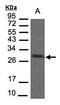 Succinate Dehydrogenase Complex Iron Sulfur Subunit B antibody, orb73928, Biorbyt, Western Blot image 