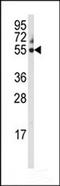 Cytochrome P450 Family 3 Subfamily A Member 5 antibody, TA324989, Origene, Western Blot image 
