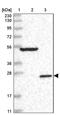 Deleted In Primary Ciliary Dyskinesia Homolog (Mouse) antibody, PA5-57738, Invitrogen Antibodies, Western Blot image 