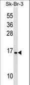 Urotensin 2B antibody, LS-C157339, Lifespan Biosciences, Western Blot image 