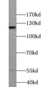 Tripartite Motif Containing 24 antibody, FNab08975, FineTest, Western Blot image 