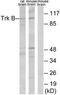 Neurotrophic Receptor Tyrosine Kinase 2 antibody, TA311829, Origene, Western Blot image 
