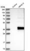 Abhydrolase Domain Containing 13 antibody, NBP1-88978, Novus Biologicals, Western Blot image 