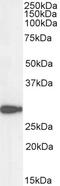 DT-diaphorase antibody, 45-981, ProSci, Immunohistochemistry frozen image 