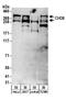 Chromodomain Helicase DNA Binding Protein 8 antibody, NB100-60417, Novus Biologicals, Western Blot image 