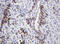 Ribophorin II antibody, LS-C173877, Lifespan Biosciences, Immunohistochemistry paraffin image 