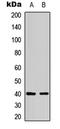 BKRB1 antibody, LS-C358929, Lifespan Biosciences, Western Blot image 