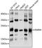 RAB9A, Member RAS Oncogene Family antibody, 22-652, ProSci, Western Blot image 
