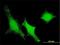 Dual Specificity Phosphatase 3 antibody, H00001845-M01, Novus Biologicals, Immunocytochemistry image 