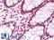 Nuclear mitotic apparatus protein 1 antibody, LS-B10896, Lifespan Biosciences, Immunohistochemistry frozen image 
