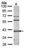 Calcium/calmodulin-dependent protein kinase type 1D antibody, orb74264, Biorbyt, Western Blot image 