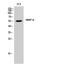 Matrix Metallopeptidase 8 antibody, PA5-51003, Invitrogen Antibodies, Western Blot image 