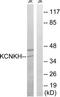 Potassium Two Pore Domain Channel Subfamily K Member 17 antibody, TA315962, Origene, Western Blot image 