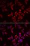 Natural Cytotoxicity Triggering Receptor 3 antibody, orb373553, Biorbyt, Immunocytochemistry image 