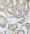 Mitochondrial Ribosomal Protein S22 antibody, FNab05353, FineTest, Immunohistochemistry paraffin image 
