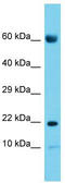 Cornichon Family AMPA Receptor Auxiliary Protein 2 antibody, TA331544, Origene, Western Blot image 