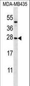 Killer Cell Lectin Like Receptor C1 antibody, LS-C165590, Lifespan Biosciences, Western Blot image 