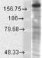 Glutamate Ionotropic Receptor NMDA Type Subunit 2B antibody, NBP1-47611, Novus Biologicals, Western Blot image 
