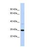 Chromosome 1 Open Reading Frame 74 antibody, NBP1-70456, Novus Biologicals, Western Blot image 