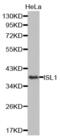 ISL LIM Homeobox 1 antibody, abx004028, Abbexa, Western Blot image 