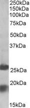 Protein Mpv17 antibody, EB10432, Everest Biotech, Western Blot image 