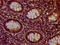 Histone Cluster 1 H1 Family Member E antibody, LS-C676872, Lifespan Biosciences, Immunohistochemistry paraffin image 