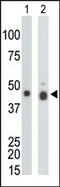Creatine Kinase B antibody, AP13617PU-N, Origene, Western Blot image 