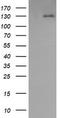 Platelet Derived Growth Factor Receptor Beta antibody, TA506231AM, Origene, Western Blot image 