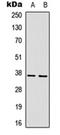 GPI-linked NAD(P)(+)--arginine ADP-ribosyltransferase 1 antibody, orb315755, Biorbyt, Western Blot image 