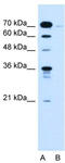 Kelch Like Family Member 31 antibody, TA335310, Origene, Western Blot image 