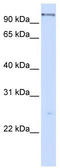 DEAH-Box Helicase 15 antibody, TA341558, Origene, Western Blot image 