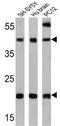 Presenilin 2 antibody, NB100-74512, Novus Biologicals, Western Blot image 