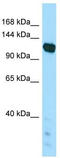 Papilin, Proteoglycan Like Sulfated Glycoprotein antibody, TA331346, Origene, Western Blot image 