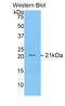 Fibrinogen Alpha Chain antibody, LS-C302817, Lifespan Biosciences, Western Blot image 
