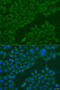 Beta-1,3-N-Acetylgalactosaminyltransferase 1 (Globoside Blood Group) antibody, 23-159, ProSci, Immunofluorescence image 