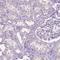 Suprabasin antibody, HPA062568, Atlas Antibodies, Immunohistochemistry paraffin image 