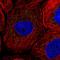 CTD Small Phosphatase 2 antibody, HPA027135, Atlas Antibodies, Immunocytochemistry image 