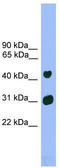 LIM/homeobox protein Lhx5 antibody, TA341788, Origene, Western Blot image 