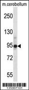 Chordin antibody, 58-213, ProSci, Western Blot image 